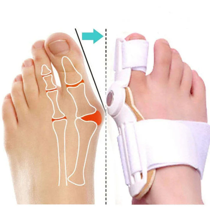 Férula Corrector de JuaneteFlex ✨🦶🏻